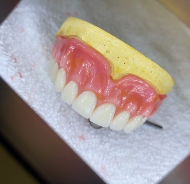 ساخت انواع دندان مصنوعی