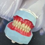 ساخت انواع دندان مصنوعی،ساخت پلاک کروم کبالت براساس فک،ساخت پروتز فلکسی و…