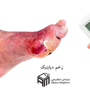 درمان زخم دیابتی | کلینیک بهبودان